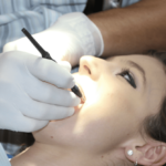Everything You Need to Know About Dental Extractions