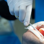 How Oral Surgeons Can Help Correct Bite and Jaw Issues